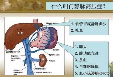 脾氣|認識脾臟：脾臟的位置及功能